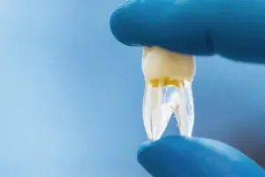 tooth-in-an-hand-MNZH5X7