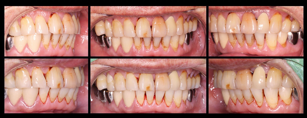 case whitening case1 1