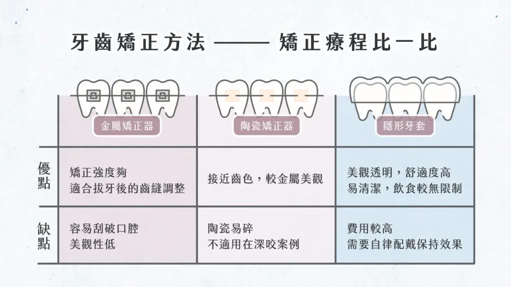牙齒矯正有什麼好處?不只笑容變美,改善咬合更健康 2 牙齒矯正方法-北大昕成