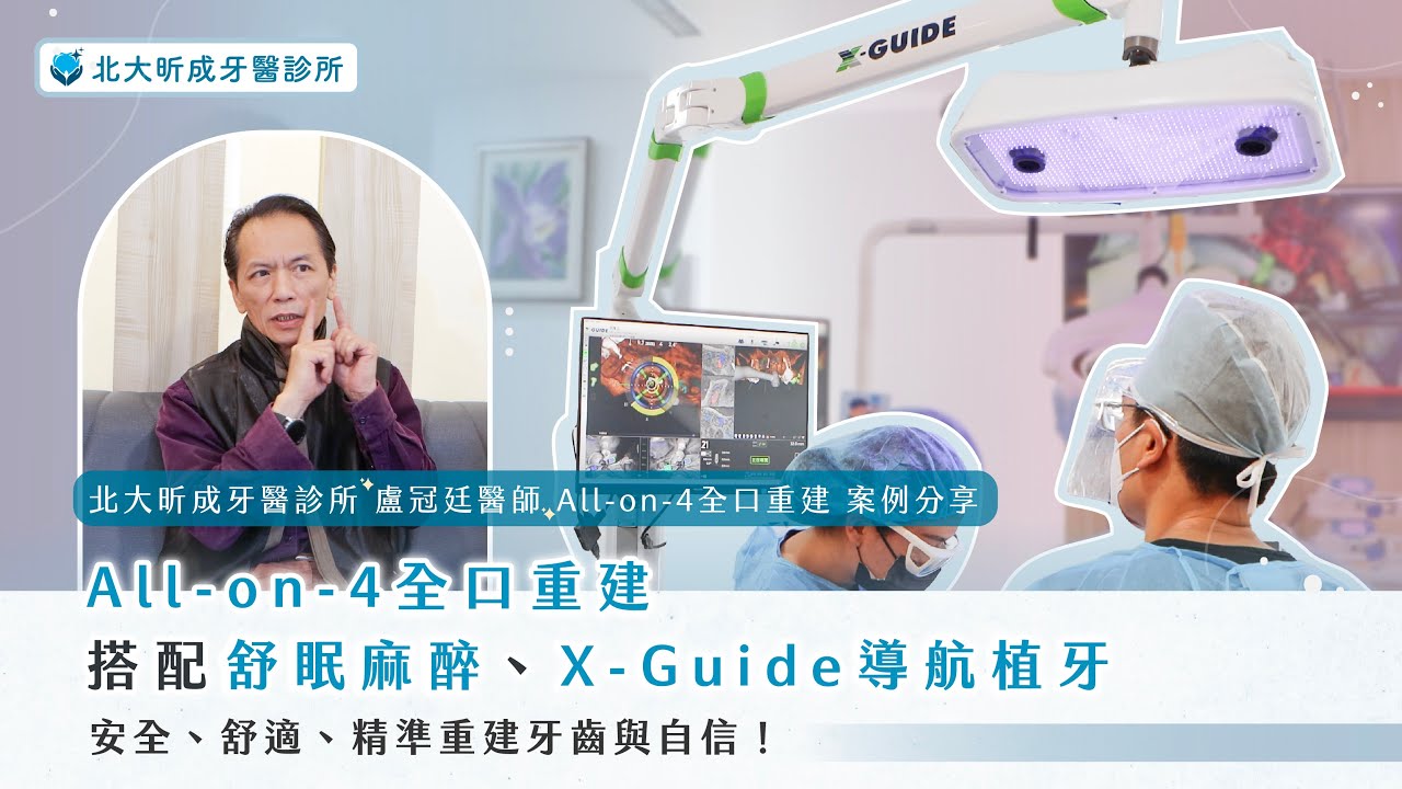 All-on-4全口重建！安全、舒適、精準重建牙齒與自信