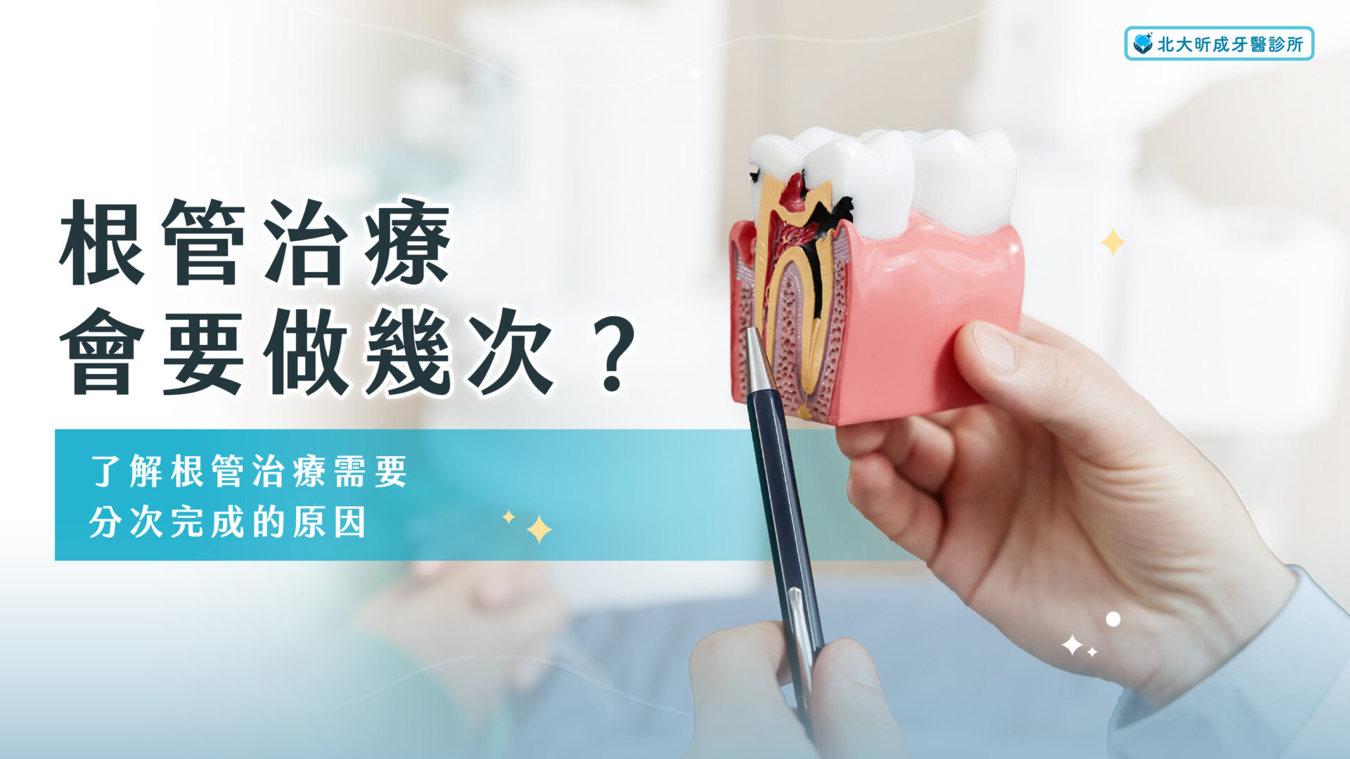 Read more about the article 根管治療要做幾次？了解根管治療需要分次完成的原因