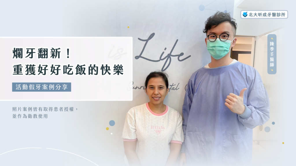 活動假牙案例-北大昕成