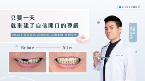 allon4案例-北大昕成